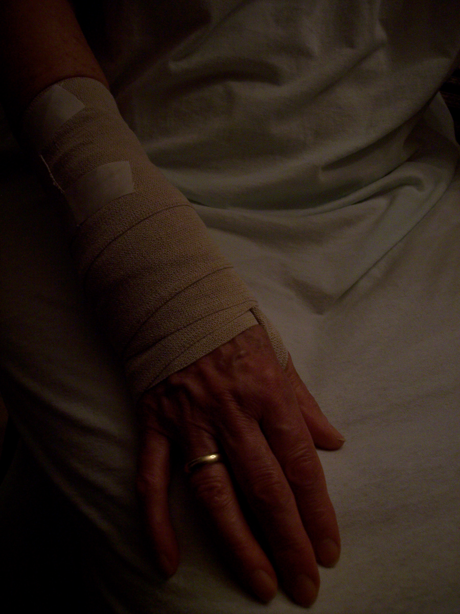 Bandagierter Unterarm einer goldberingten alten Frau im weißen Kittel; Foto